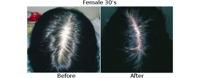 female30s3