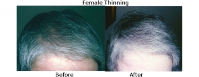 femalethinning3